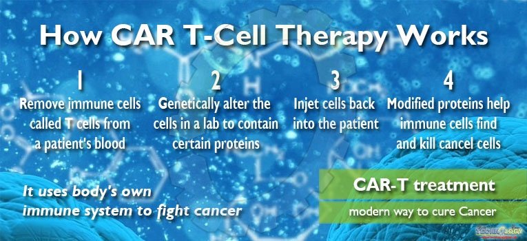 CAR-T treatment – modern way to cure Cancer