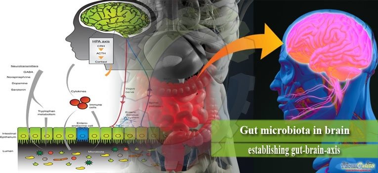 Gut microbiota in brain - establishing gut-brain-axis