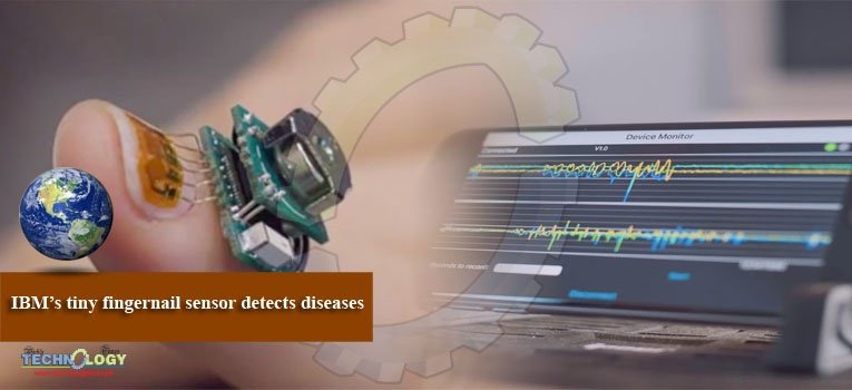 IBM’s tiny fingernail sensor detects diseases