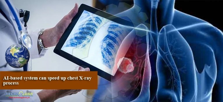 AI-based system can speed up chest X-ray process
