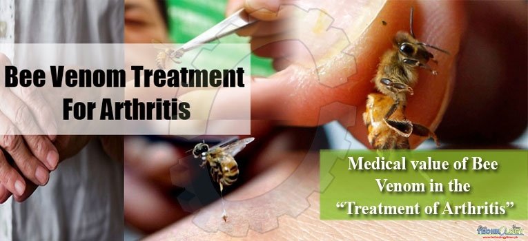 Medical value of Bee Venom in the “Treatment of Arthritis”