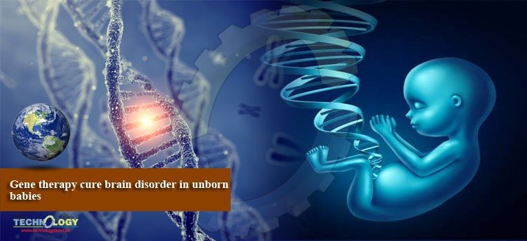 Gene therapy cure brain disorder in unborn babies