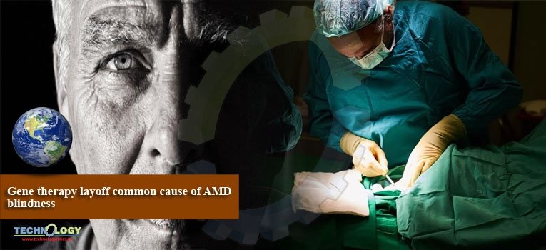 Gene therapy layoff common cause of AMD blindness
