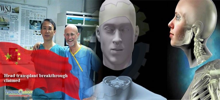 Head transplant breakthrough claimed