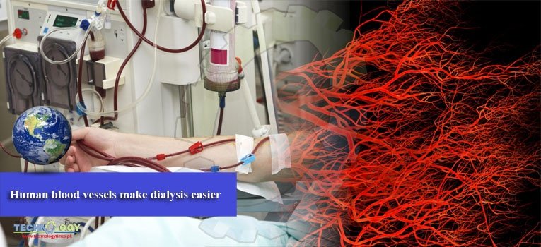 Human blood vessels make dialysis easier