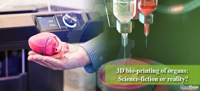 3D bio-printing of organs Science-fiction or reality