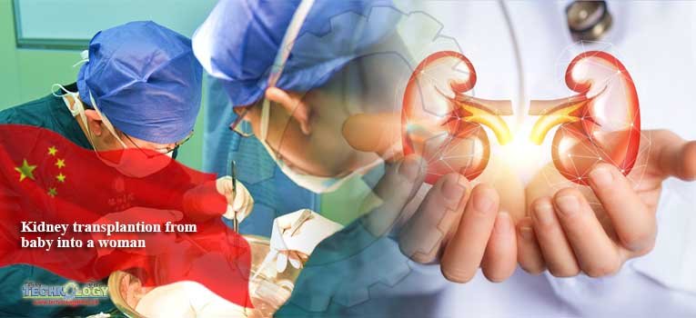 Kidney transplantion from baby into a woman