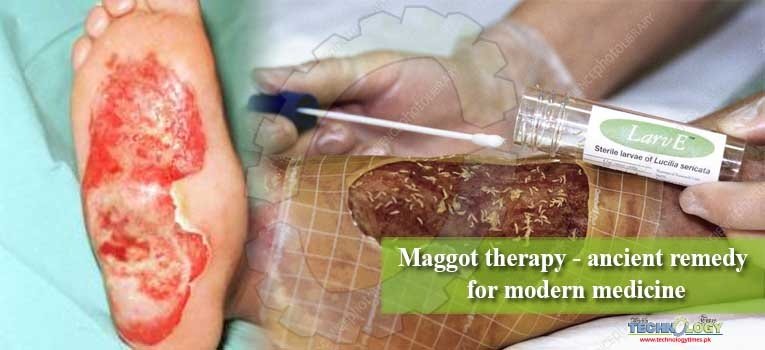 Maggot therapy - ancient remedy for modern medicine