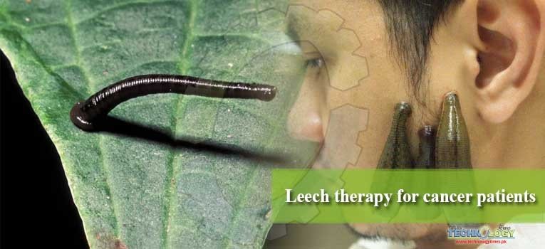 Leech therapy for cancer patients