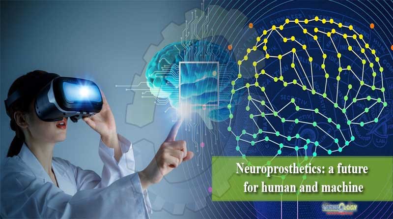Neuroprosthetics a future for human and machine