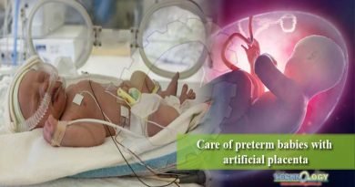 Care of preterm babies with artificial placenta