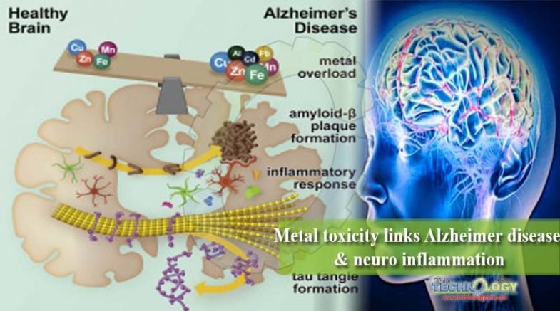 Metal toxicity links Alzheimer disease & neuro inflammation