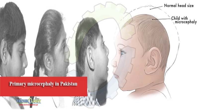 Primary microcephaly in Pakistan