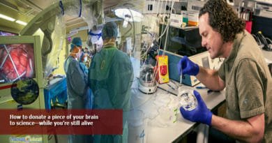 How-to-donate-a-piece-of-your-brain-to-science—while-you’re-still-alive