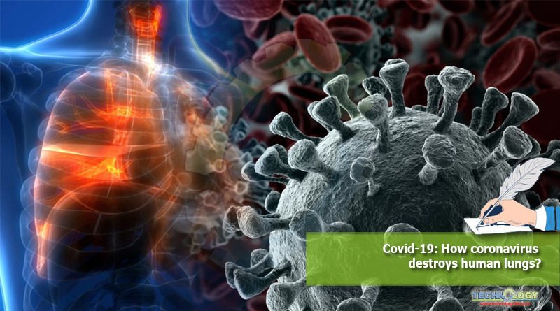Covid-19 How coronavirus destroys human lungs