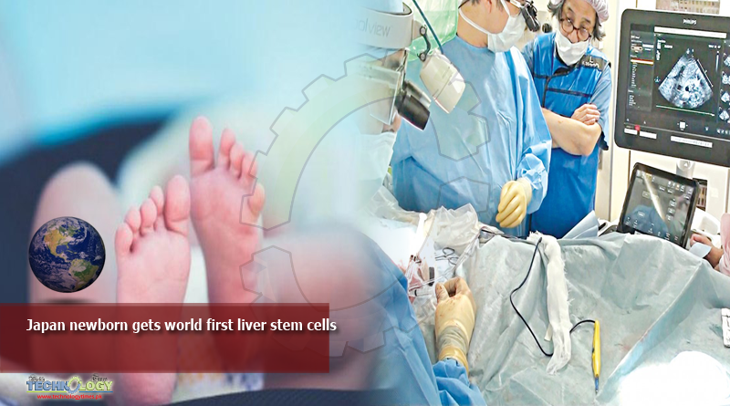 Japan newborn gets world first liver stem cells