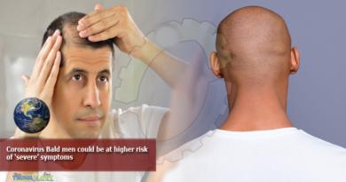 Coronavirus-Bald-men-could-be-at-higher-risk-of-‘severe’-symptoms