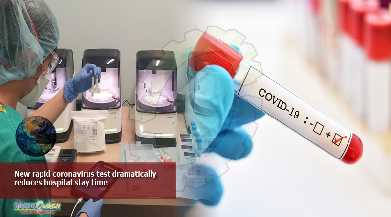 New rapid coronavirus test dramatically reduces hospital stay time