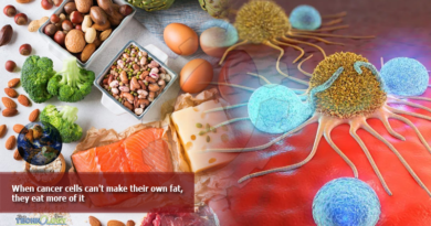When-cancer-cells-cant-make-their-own-fat-they-eat-more-of-it