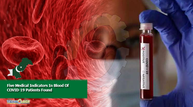 Five Medical Indicators In Blood Of COVID-19 Patients Found