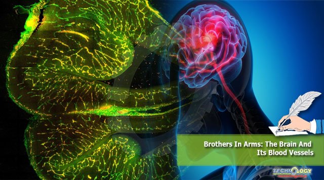 Brothers-In-Arms-The-Brain-And-Its-Blood-Vessels.