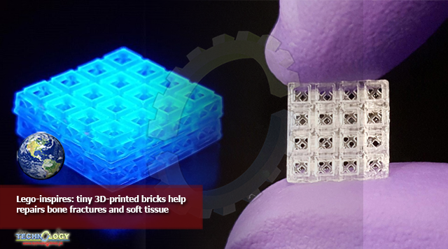 Lego-inspires: tiny 3D-printed bricks help repairs bone fractures and soft tissue