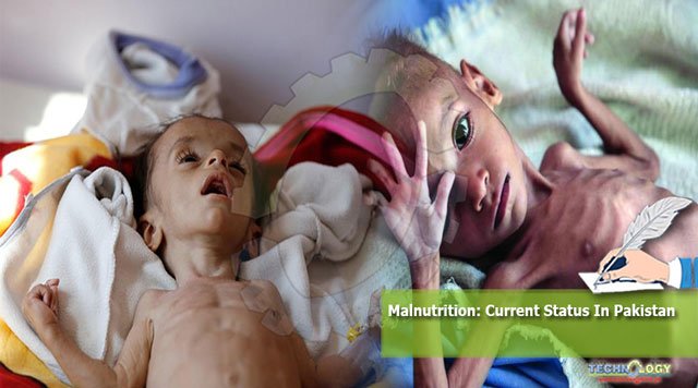 Malnutrition-Current-Status-In-Pakistan