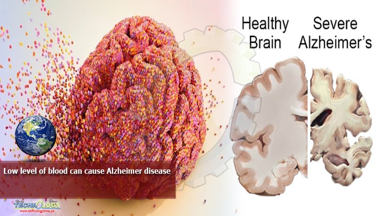Low level of blood can cause Alzheimer disease