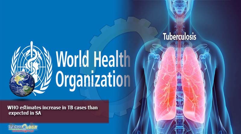 WHO estimates increase in TB cases than expected in SA