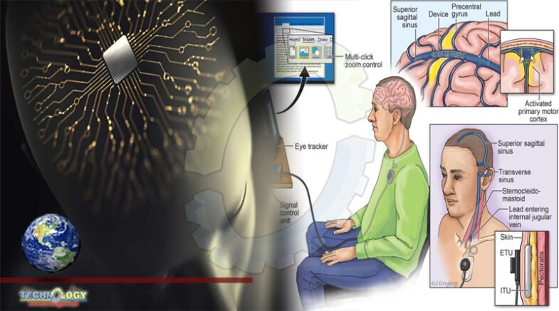 Device Allow ALS Patients To Control Computers With Their Brain 