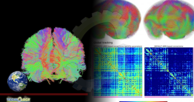 AI Accelerates Brain Connection Mapping Project