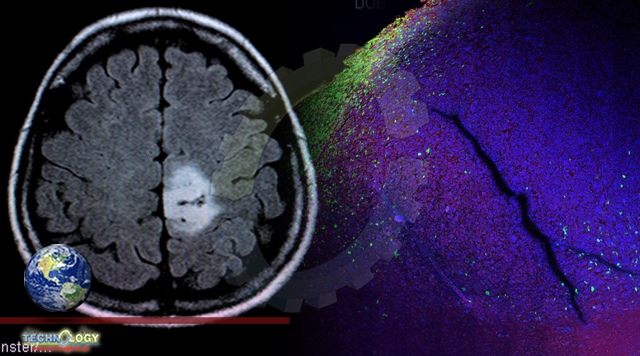 Molecular reporters expose the allies of the brain tumor