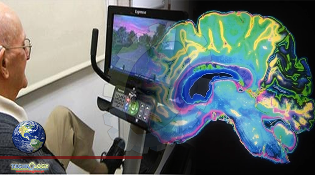 Tablet-based video games could improve brain function in older people with mild cognitive impairment