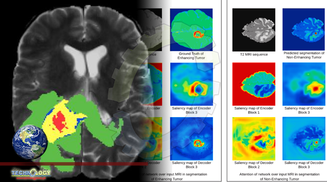 Visual interpretability in 3D brain tumor segmentation network.