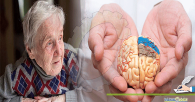Alzheimers-Disease