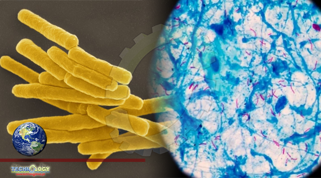 New consortium launched to advance anti-tuberculosis science
