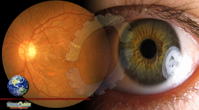 Study: Gene therapy may protect against vision loss from glaucoma, diabetes