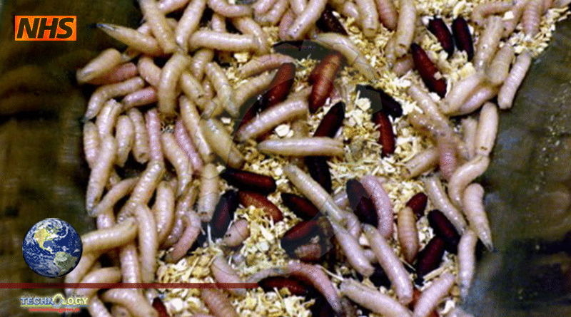 Maggots Are Being Used For Cleaning Of Wounds By Scientists