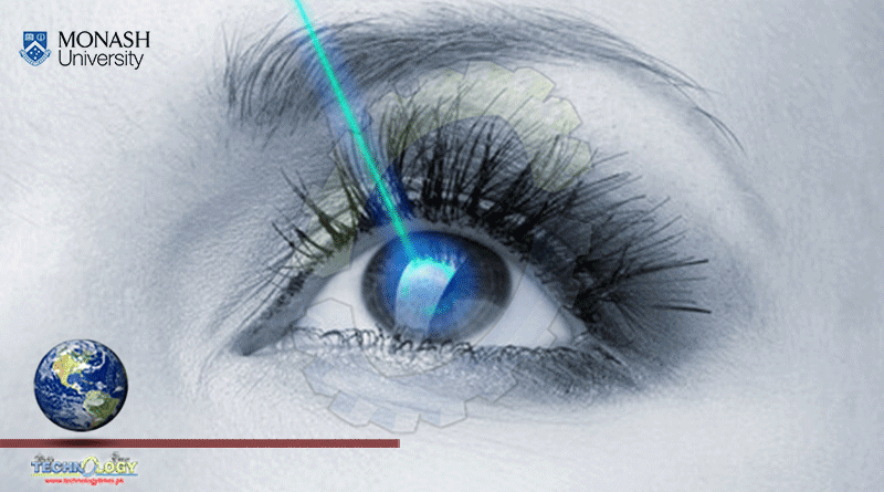 Researchers Builds A CARE System To Detect Retinal Diseases