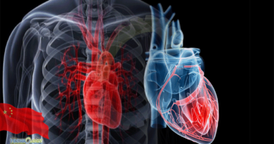 cardiac tissue