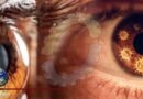 Proteins in the eye may predict which macular degeneration patients need life-long treatment
