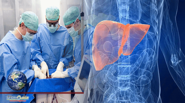 damaged-donor-liver-game-changer