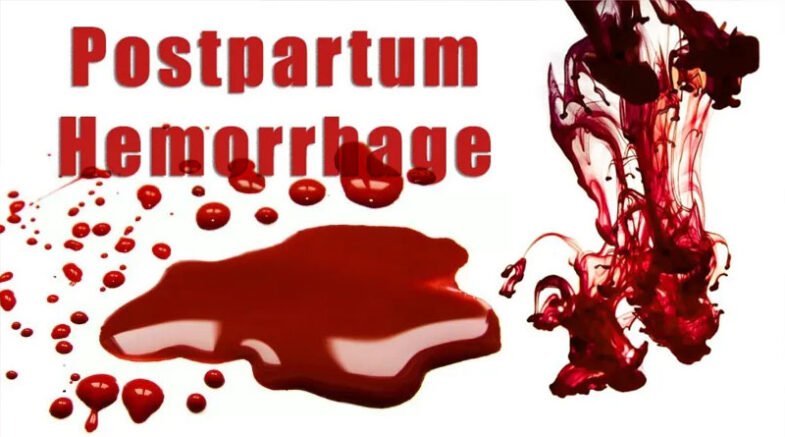 Postpartum haemorrhage can occur in 18 pc of births