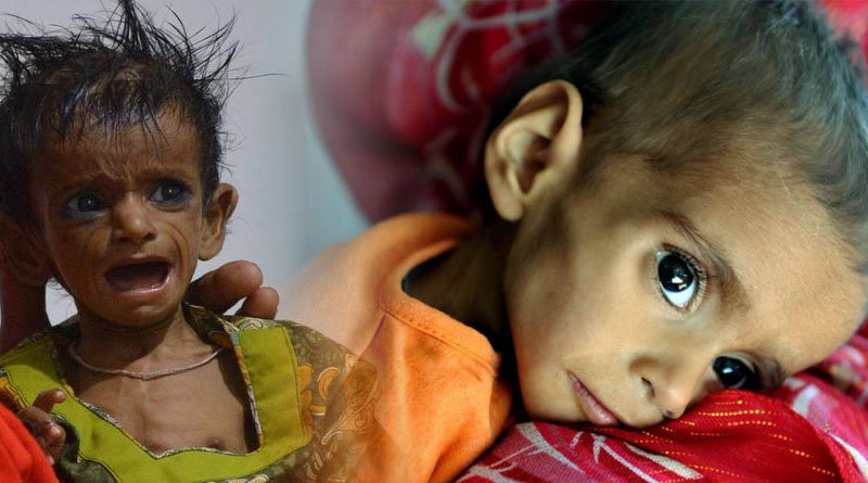 Abbott, PIA Teams Up To Raise Awareness On Child Malnutrition