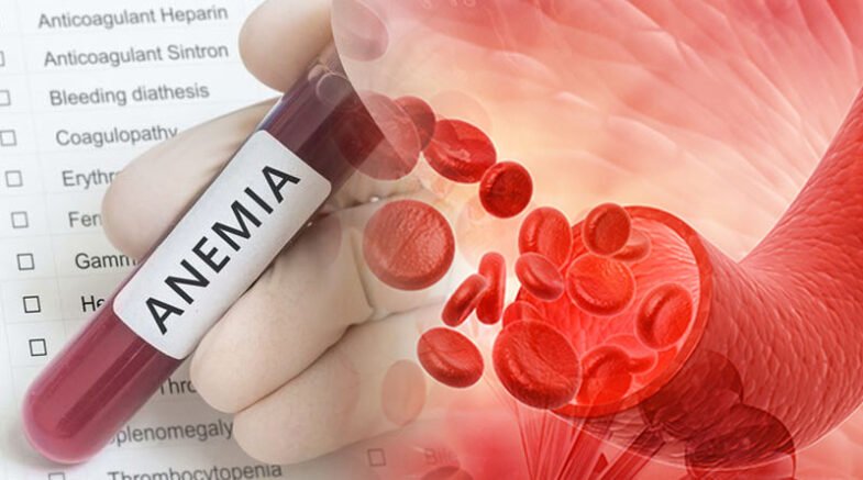 Iron Deficiency or Anemia - A Common Nutrient Deficiency