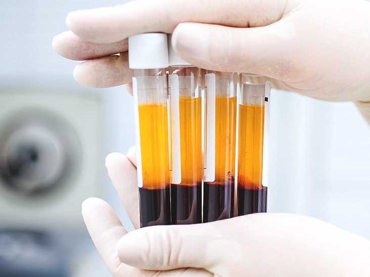 Platelets Rich Plasma Plays Crucial Role In Regulating Angiogenesis