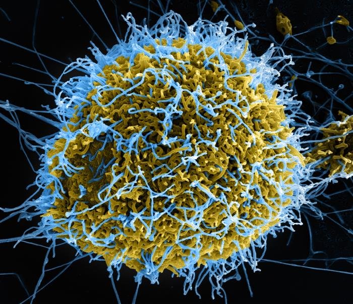 Pathogenesis And Epidemiology Of Zaire Ebola Virus In Human